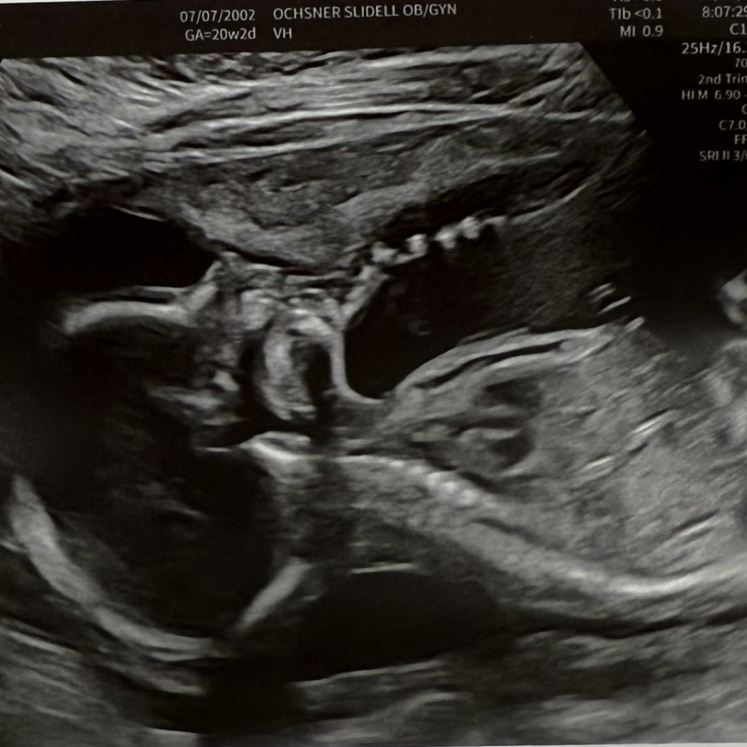 Photo shared by Abigail for their Babylist baby registry.