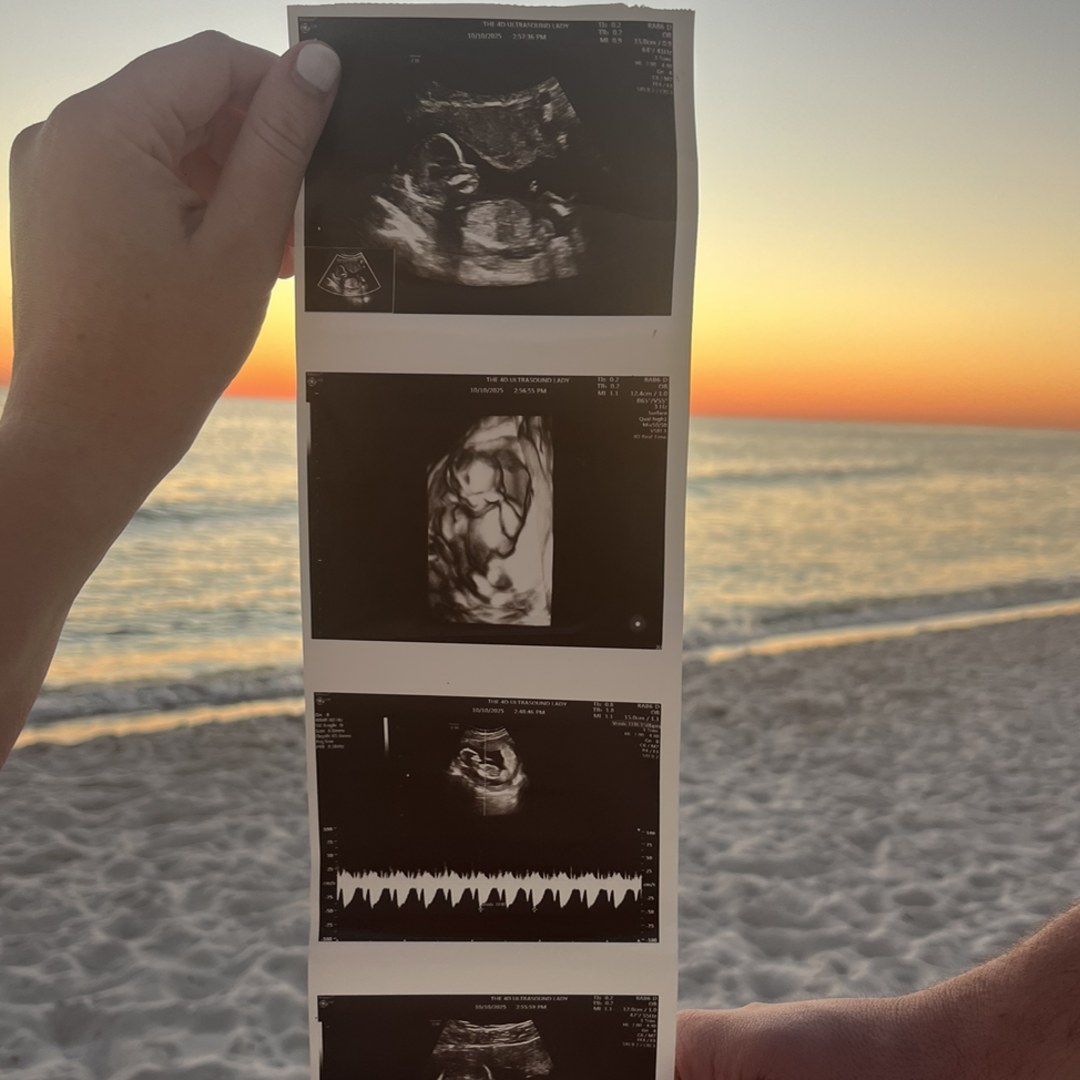 Photo shared by Aubrey for their Babylist baby registry.