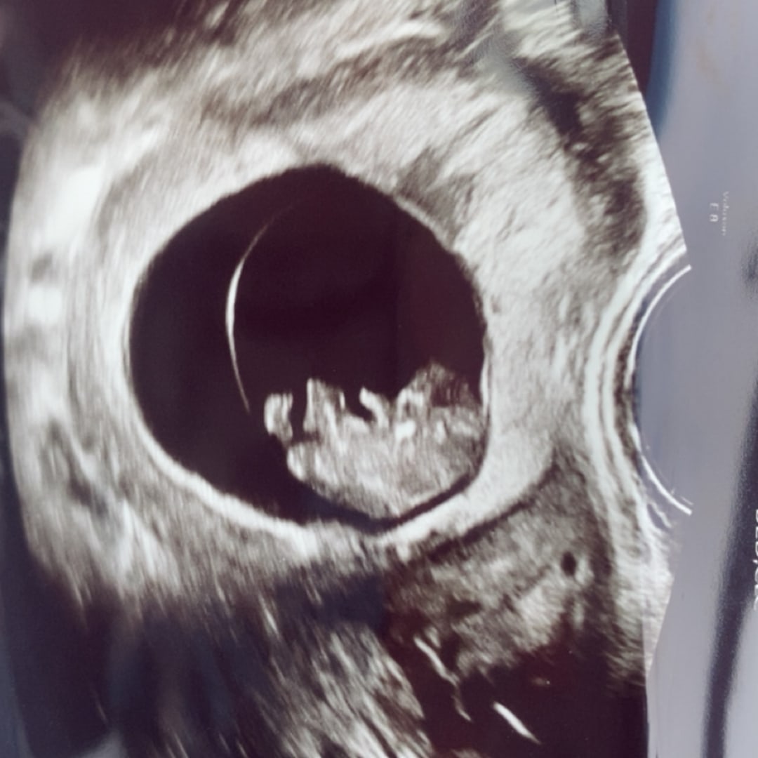 Photo shared by Makayla for their Babylist baby registry.