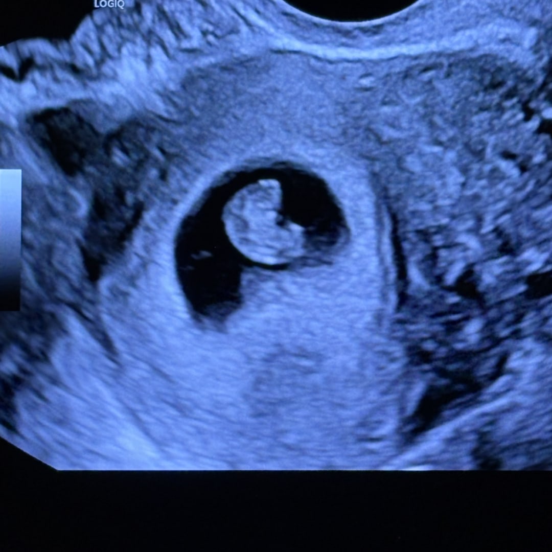 Photo shared by Kimber for their Babylist baby registry.