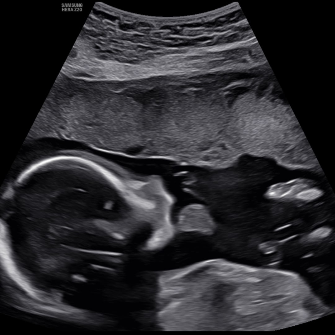 Photo shared by Gabbi for their Babylist baby registry.