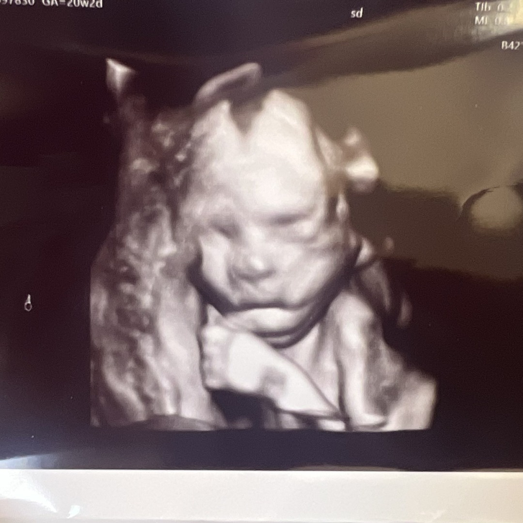 Photo shared by Rebecca for their Babylist baby registry.