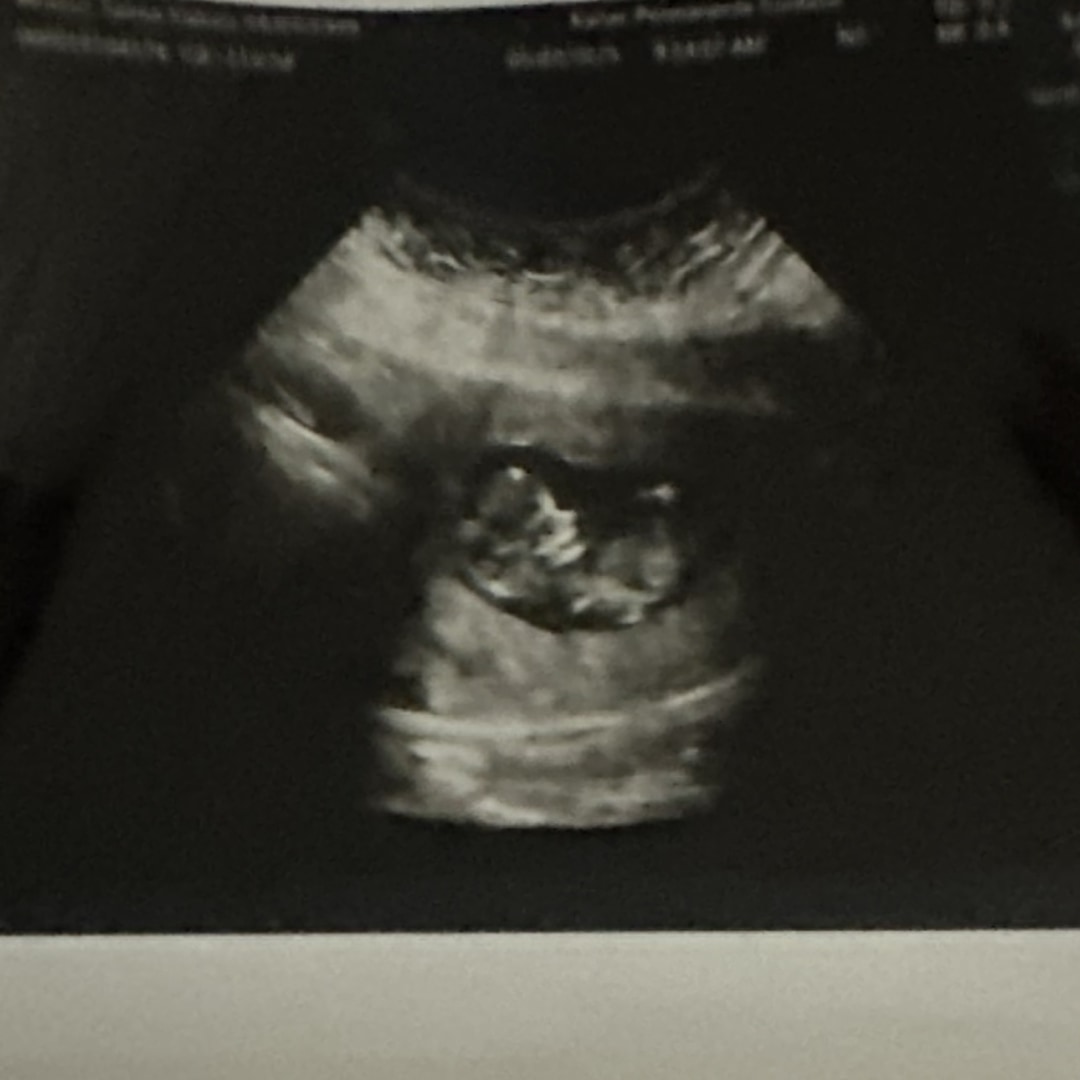 Photo shared by Salma for their Babylist baby registry.
