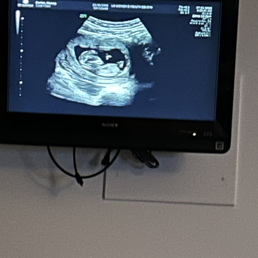 Photo shared by Alanna for their Babylist baby registry.