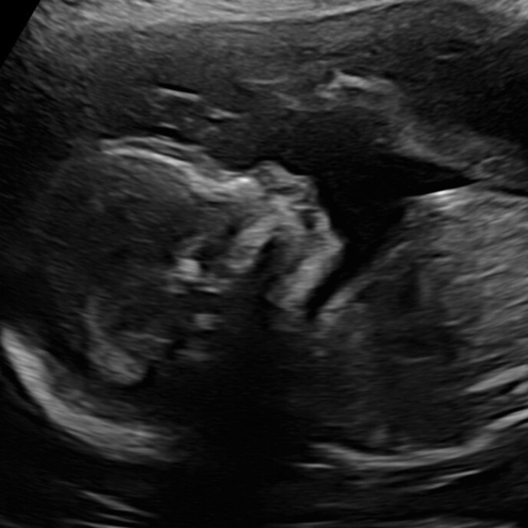 Photo shared by Alibelle for their Babylist baby registry.