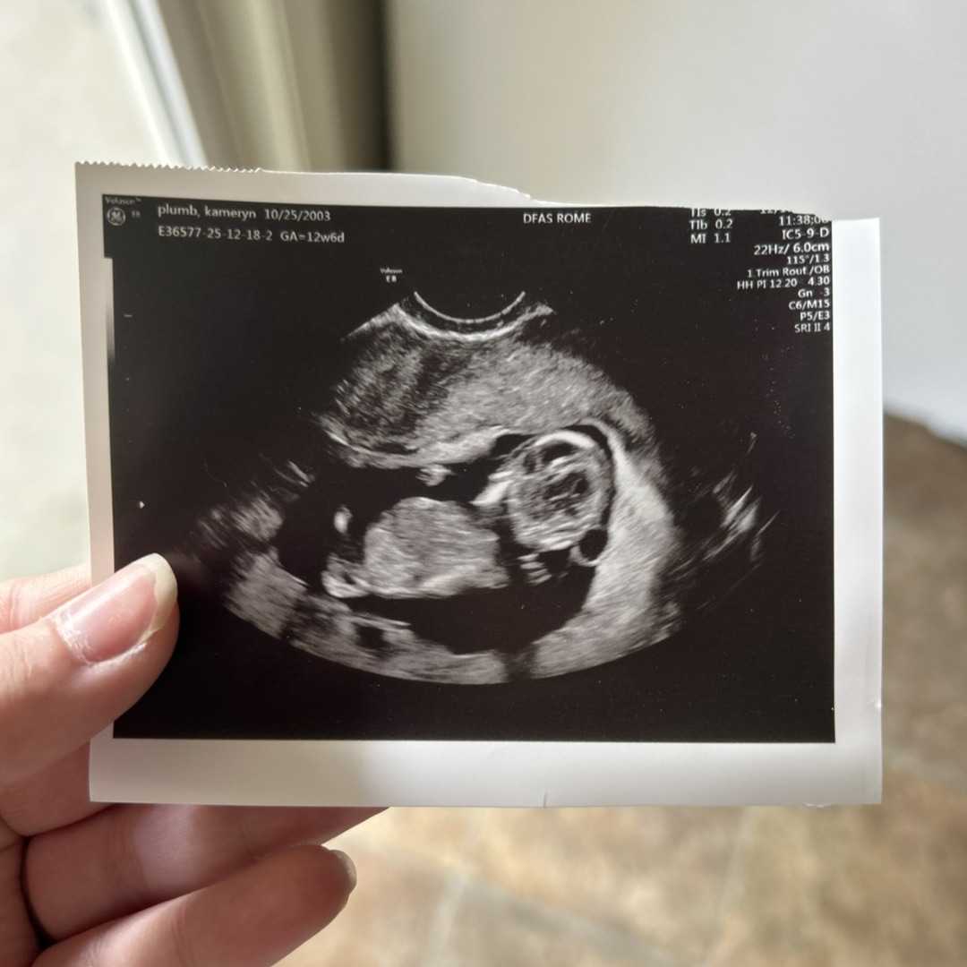 Photo shared by Kameryn for their Babylist baby registry.