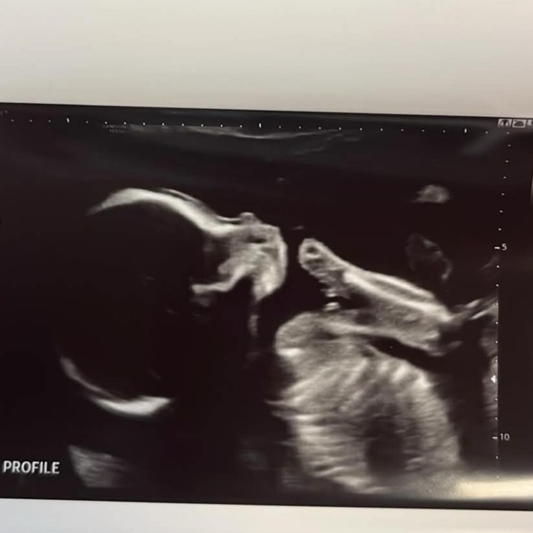 Photo shared by Elsie for their Babylist baby registry.