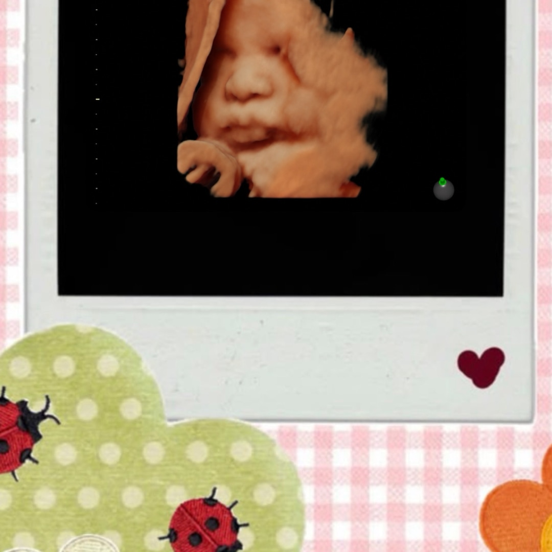 Photo shared by Arlene for their Babylist baby registry.
