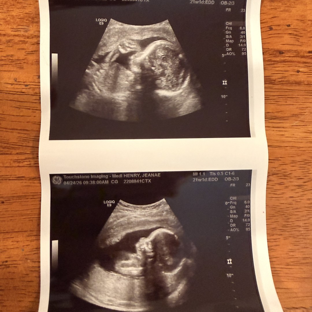 Photo shared by Jeanae for their Babylist baby registry.
