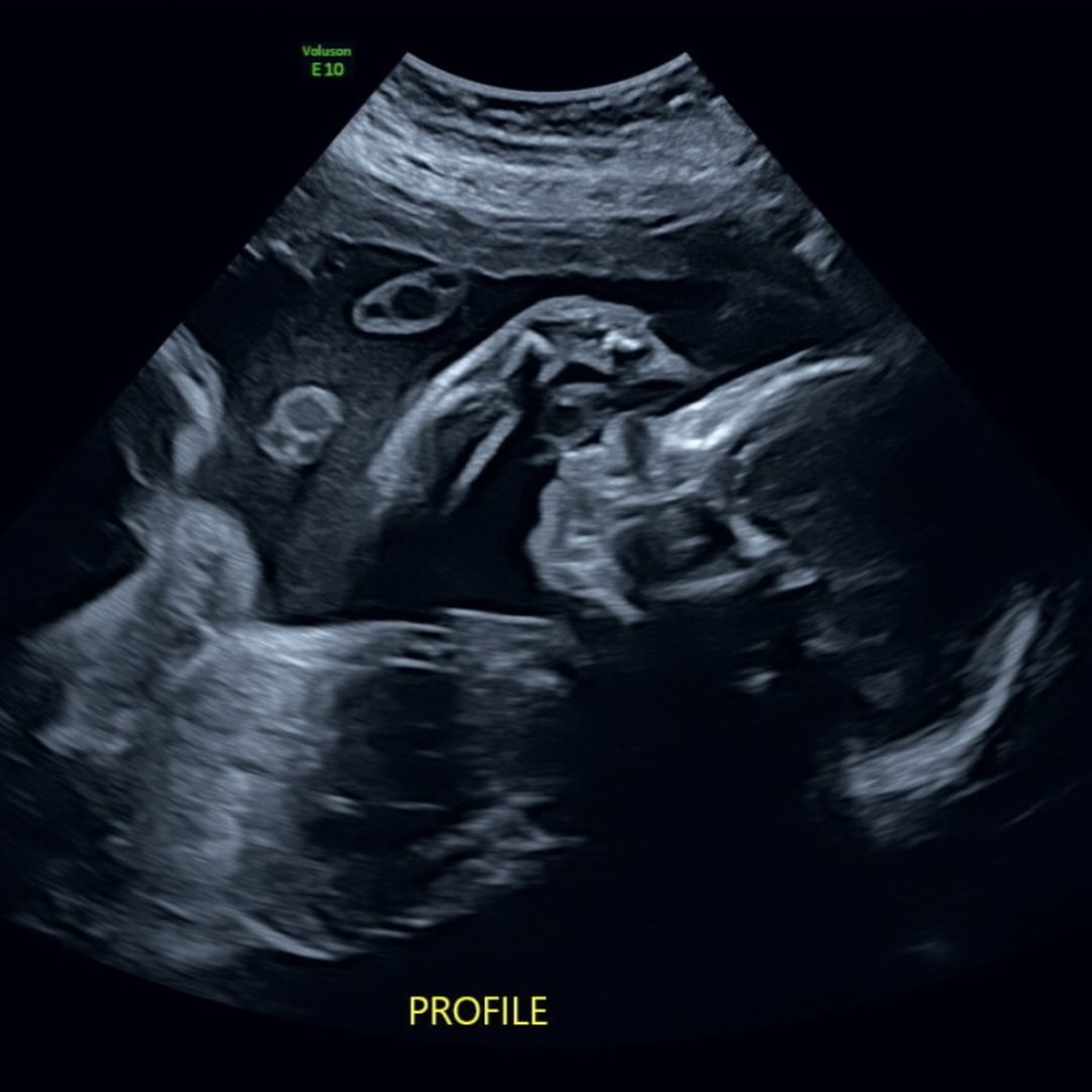 Photo shared by Daja for their Babylist baby registry.