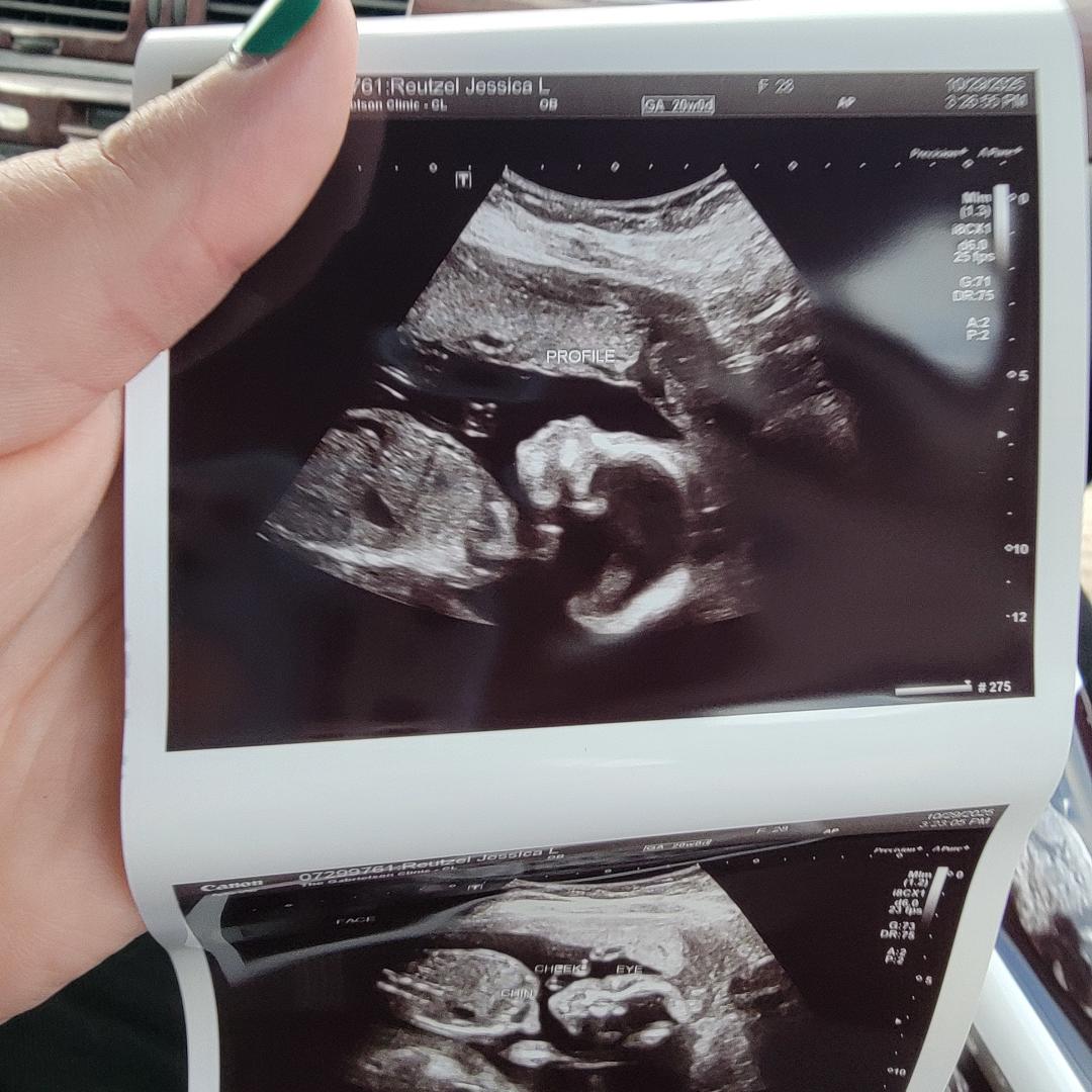 Photo shared by Jessica for their Babylist baby registry.