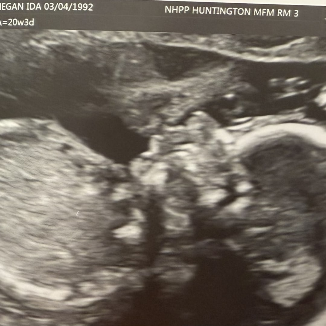 Photo shared by Megan for their Babylist baby registry.