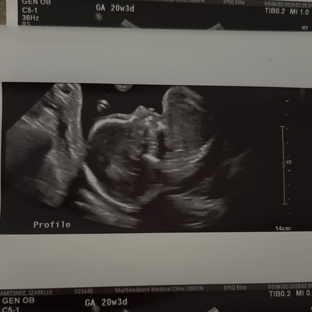 Photo shared by Izzy for their Babylist baby registry.