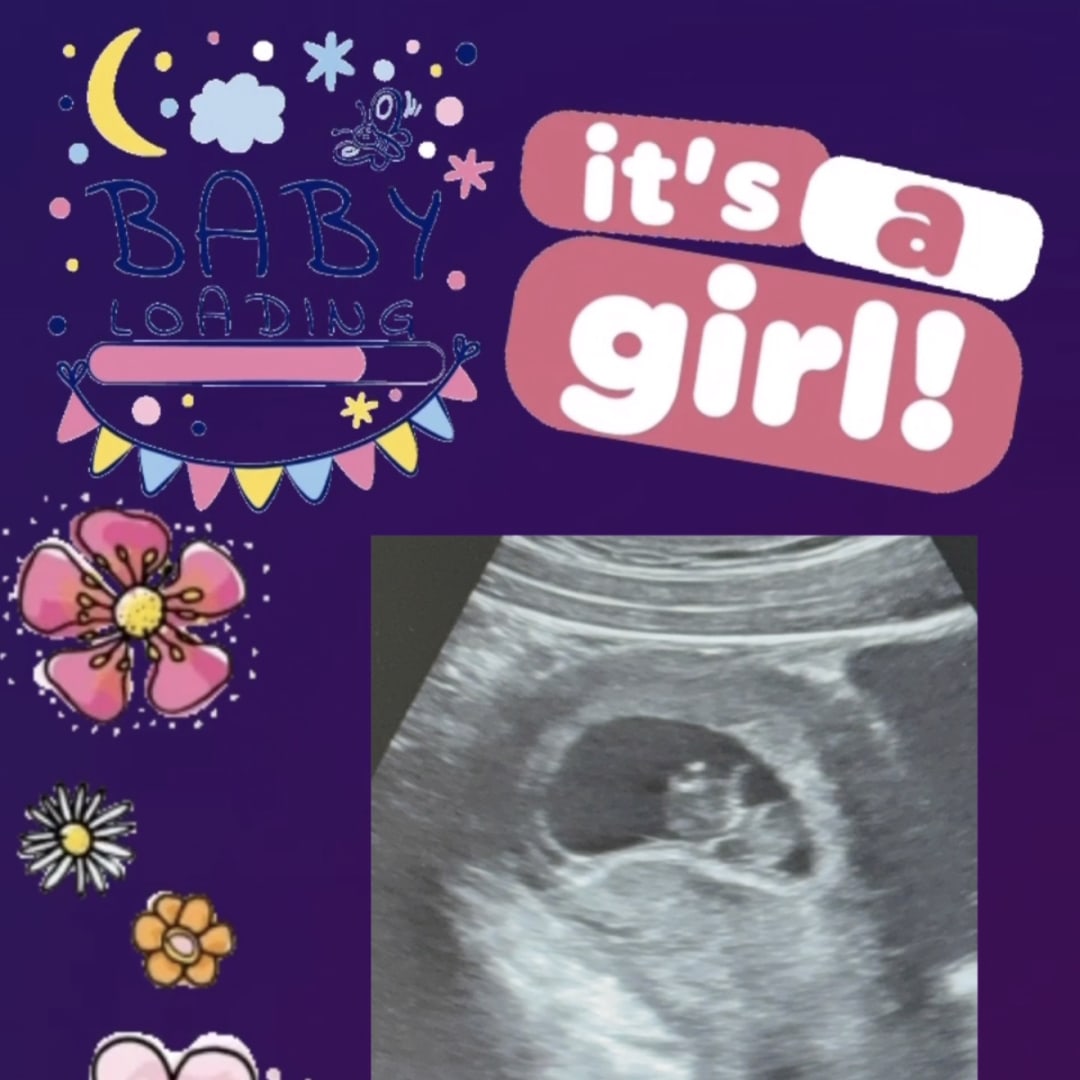 Photo shared by Simara for their Babylist baby registry.