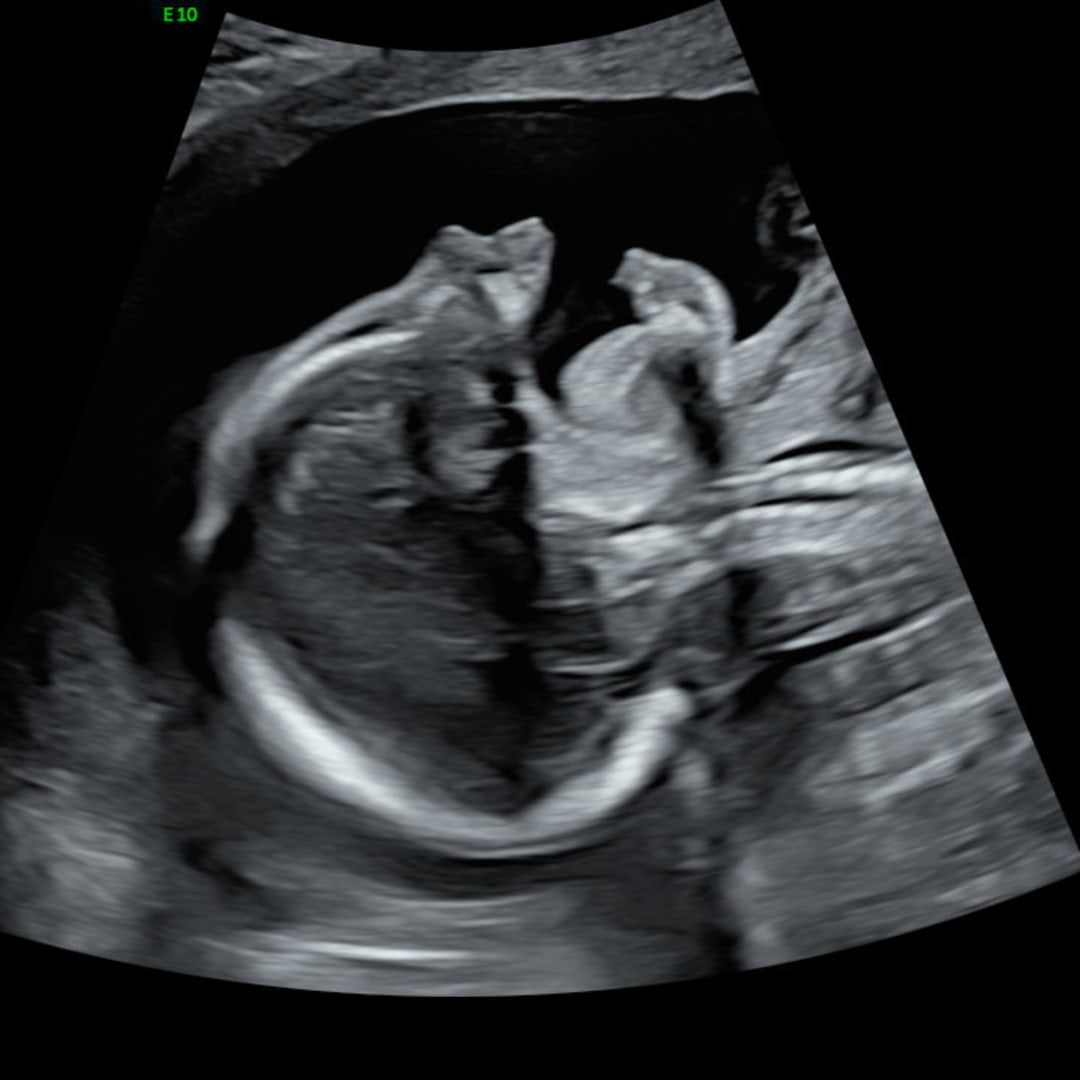 Photo shared by Dominika for their Babylist baby registry.