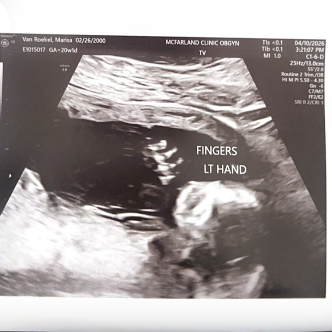 Photo shared by Marisa for their Babylist baby registry.