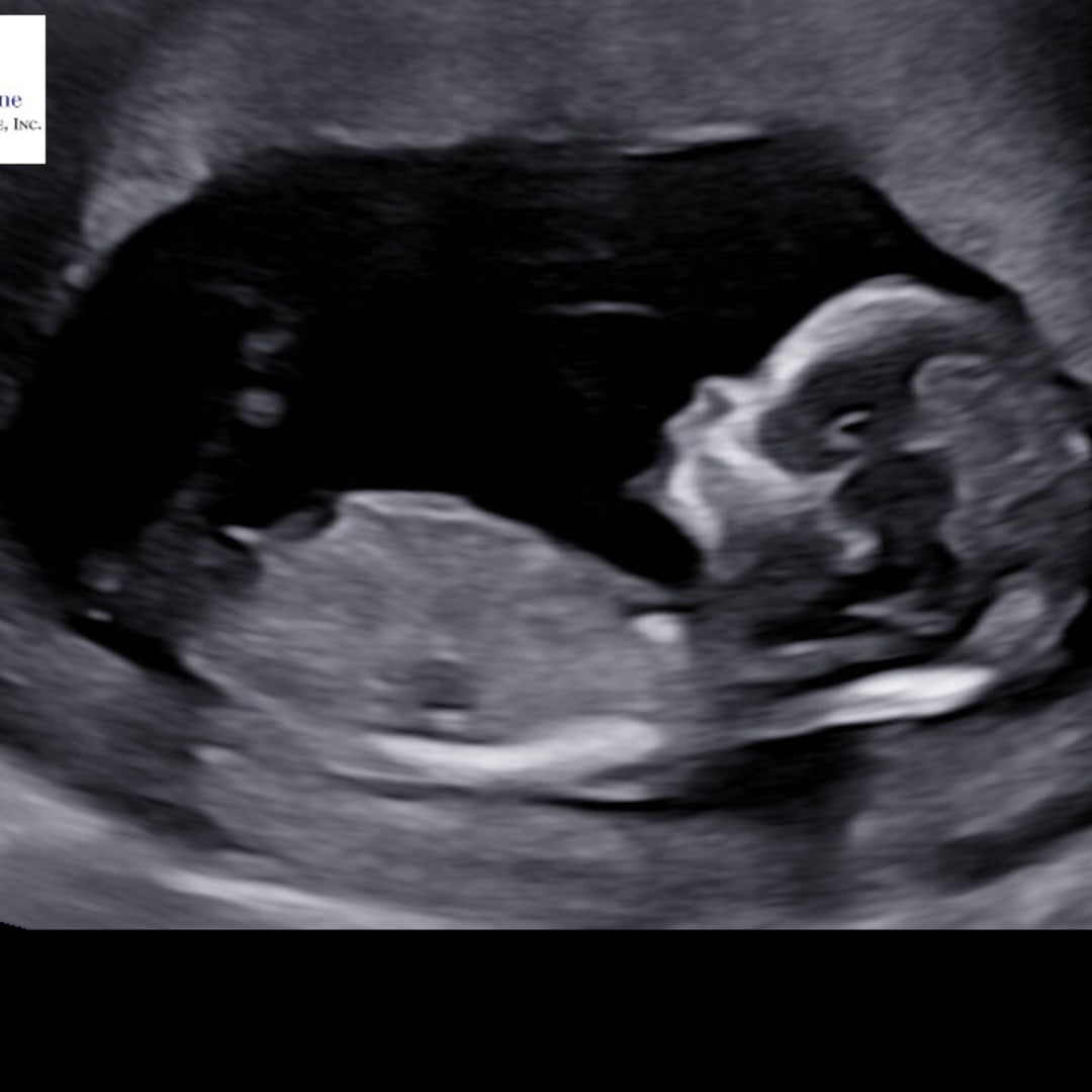 Photo shared by Jada for their Babylist baby registry.