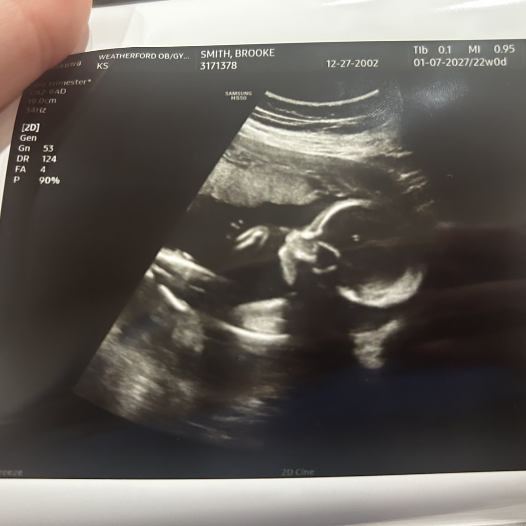 Photo shared by Brooke for their Babylist baby registry.