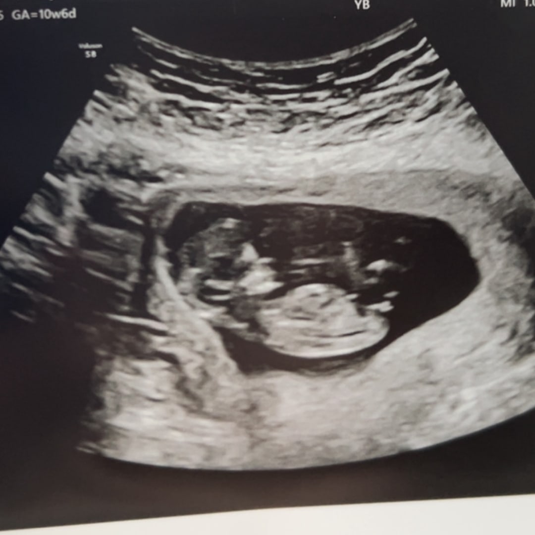 Photo shared by Emily for their Babylist baby registry.