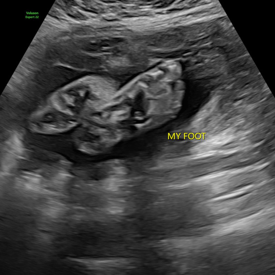 Photo shared by Sophia for their Babylist baby registry.