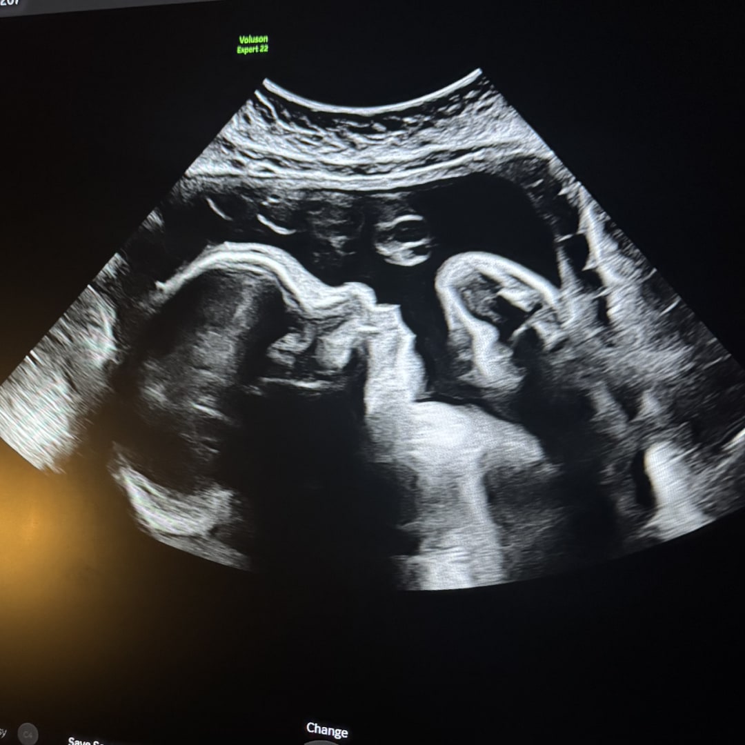 Photo shared by Mariah for their Babylist baby registry.