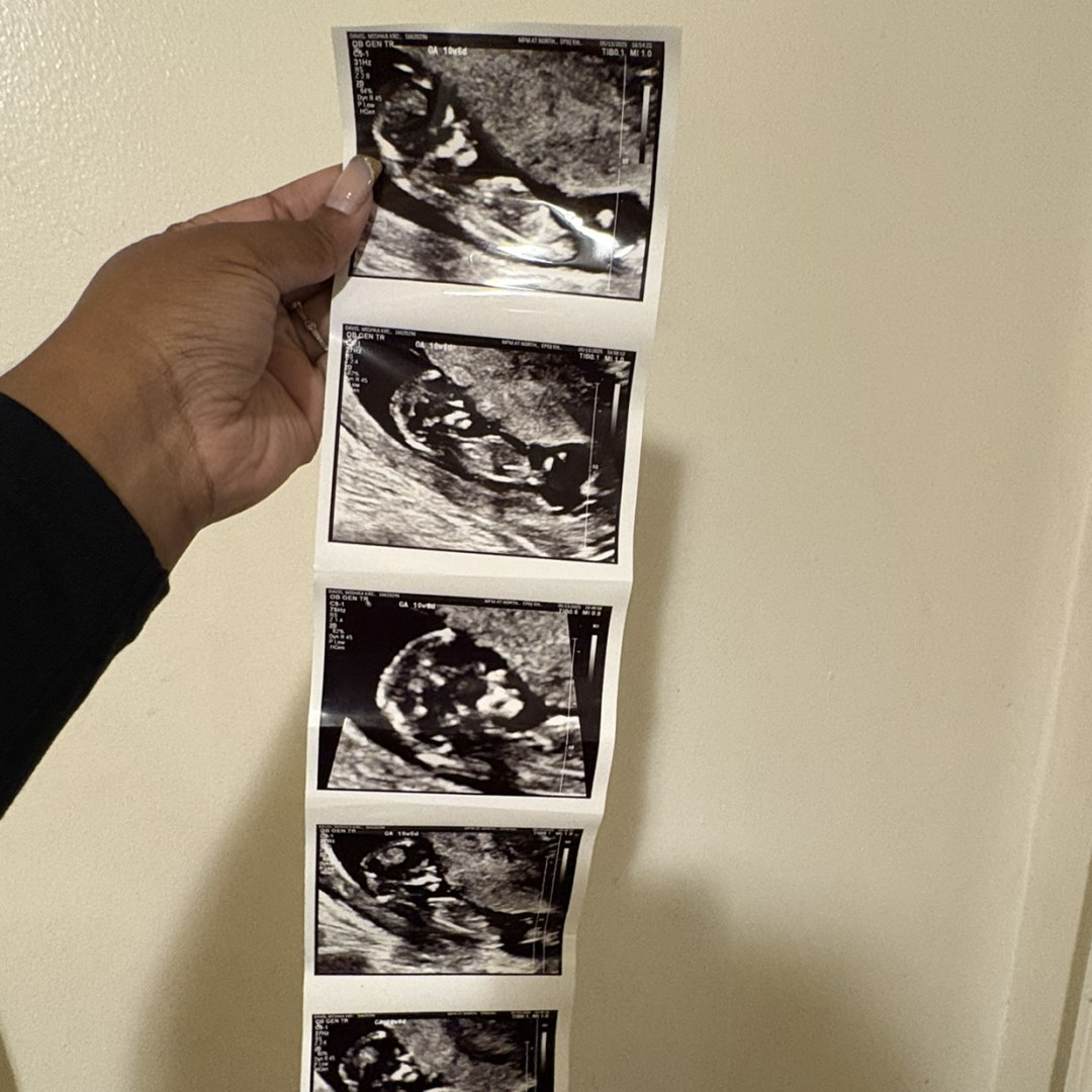 Photo shared by Mishka for their Babylist baby registry.