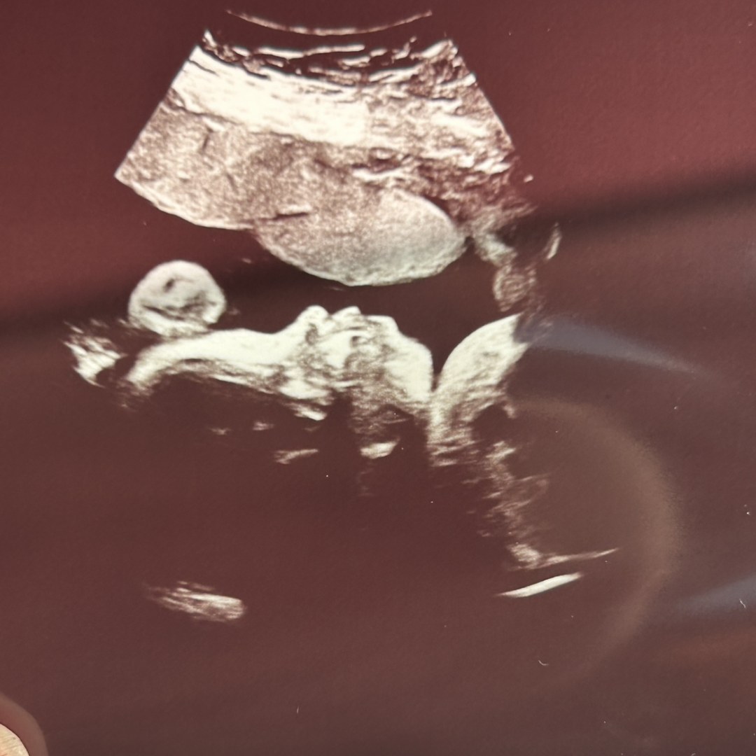 Photo shared by Brianna for their Babylist baby registry.