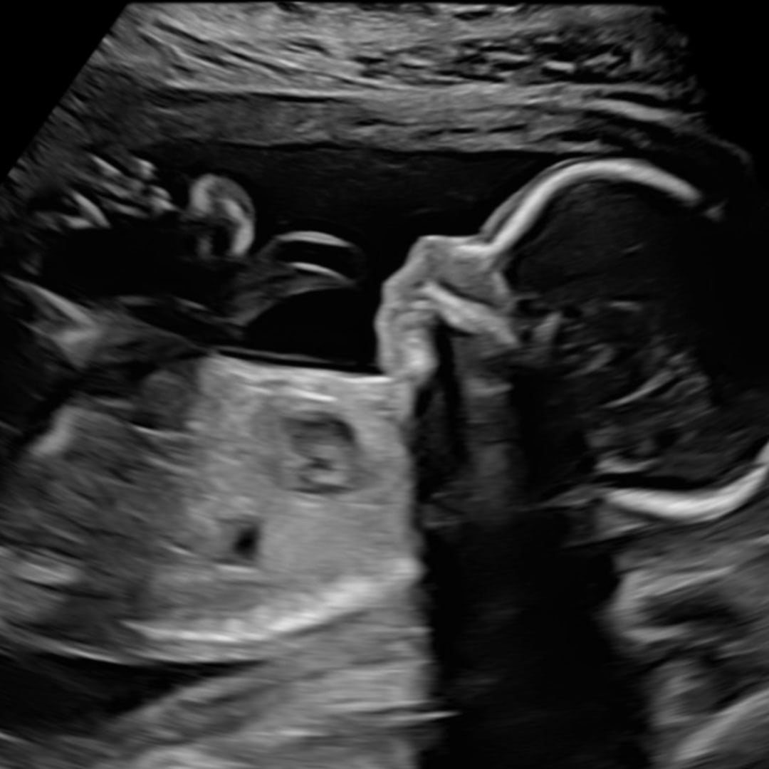 Photo shared by Isis for their Babylist baby registry.