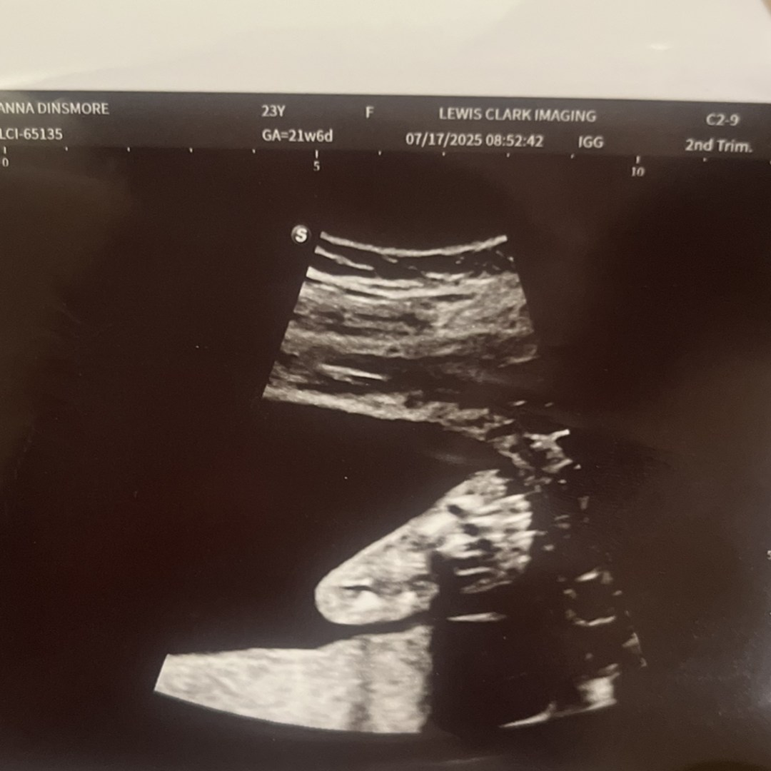 Photo shared by Anna for their Babylist baby registry.