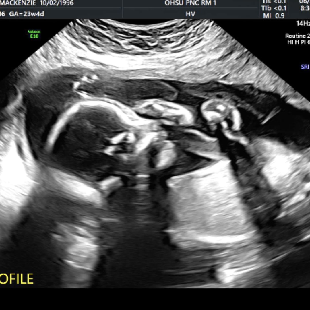 Photo shared by Mackenzie for their Babylist baby registry.
