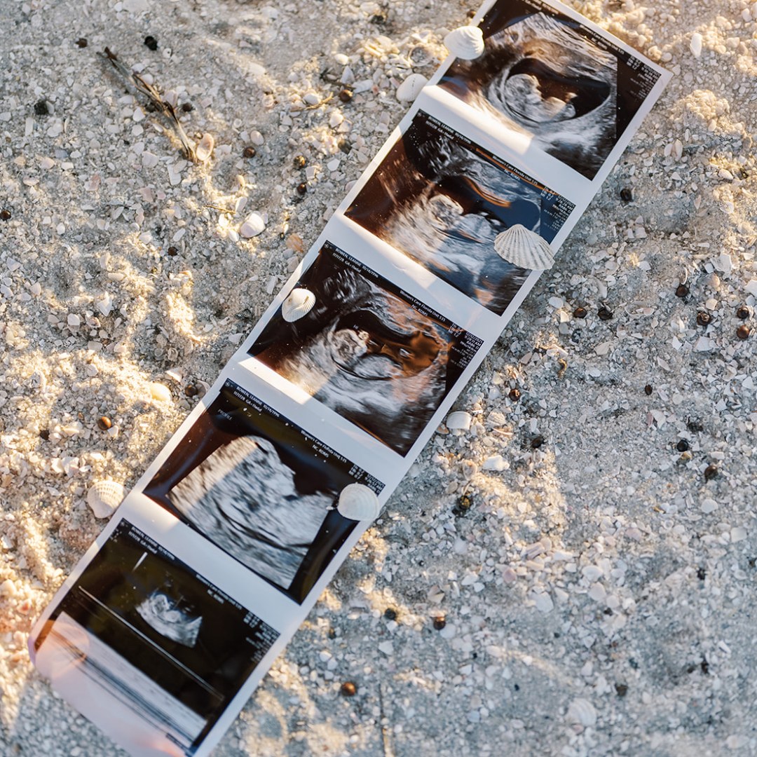 Photo shared by Leanne for their Babylist baby registry.