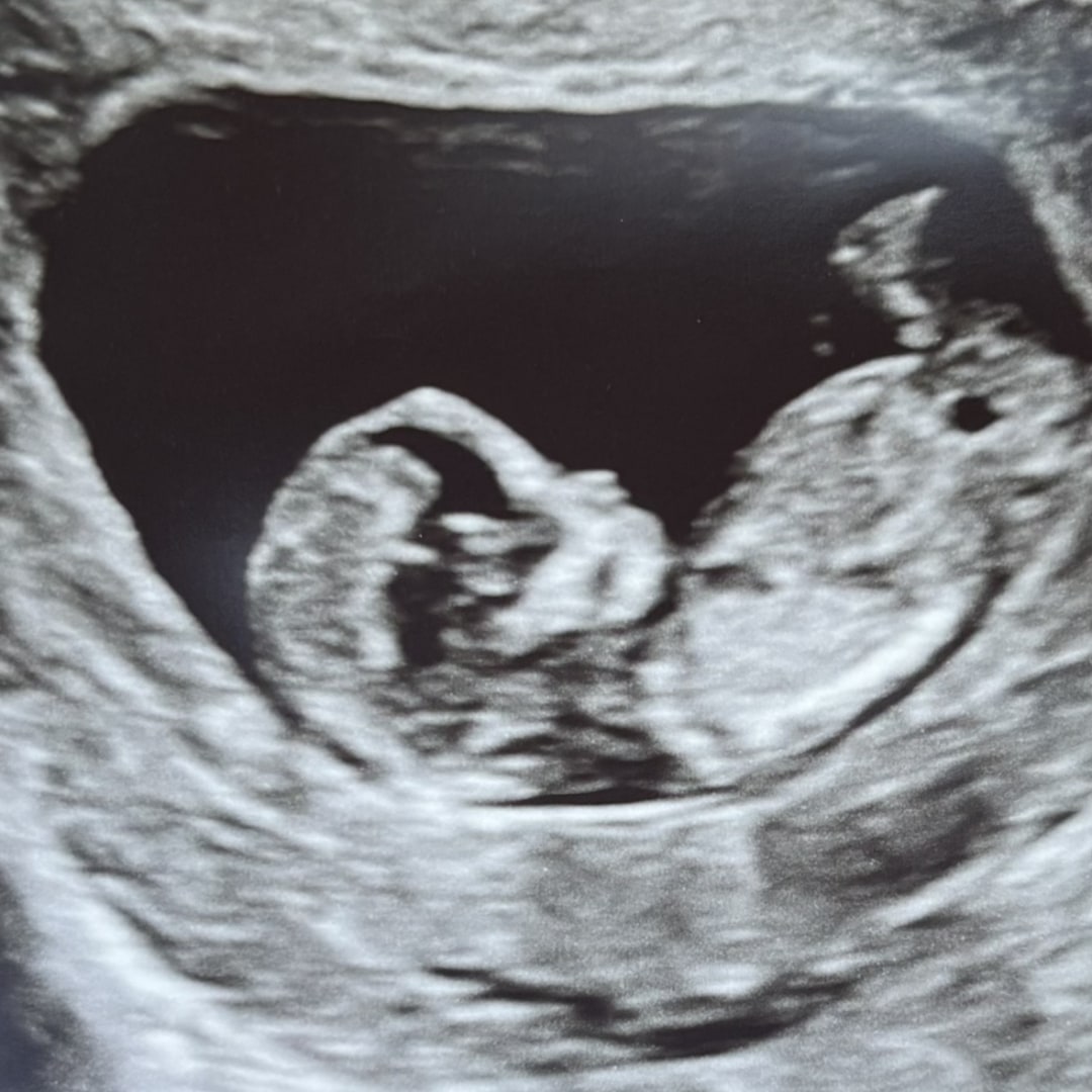 Photo shared by Ivy for their Babylist baby registry.