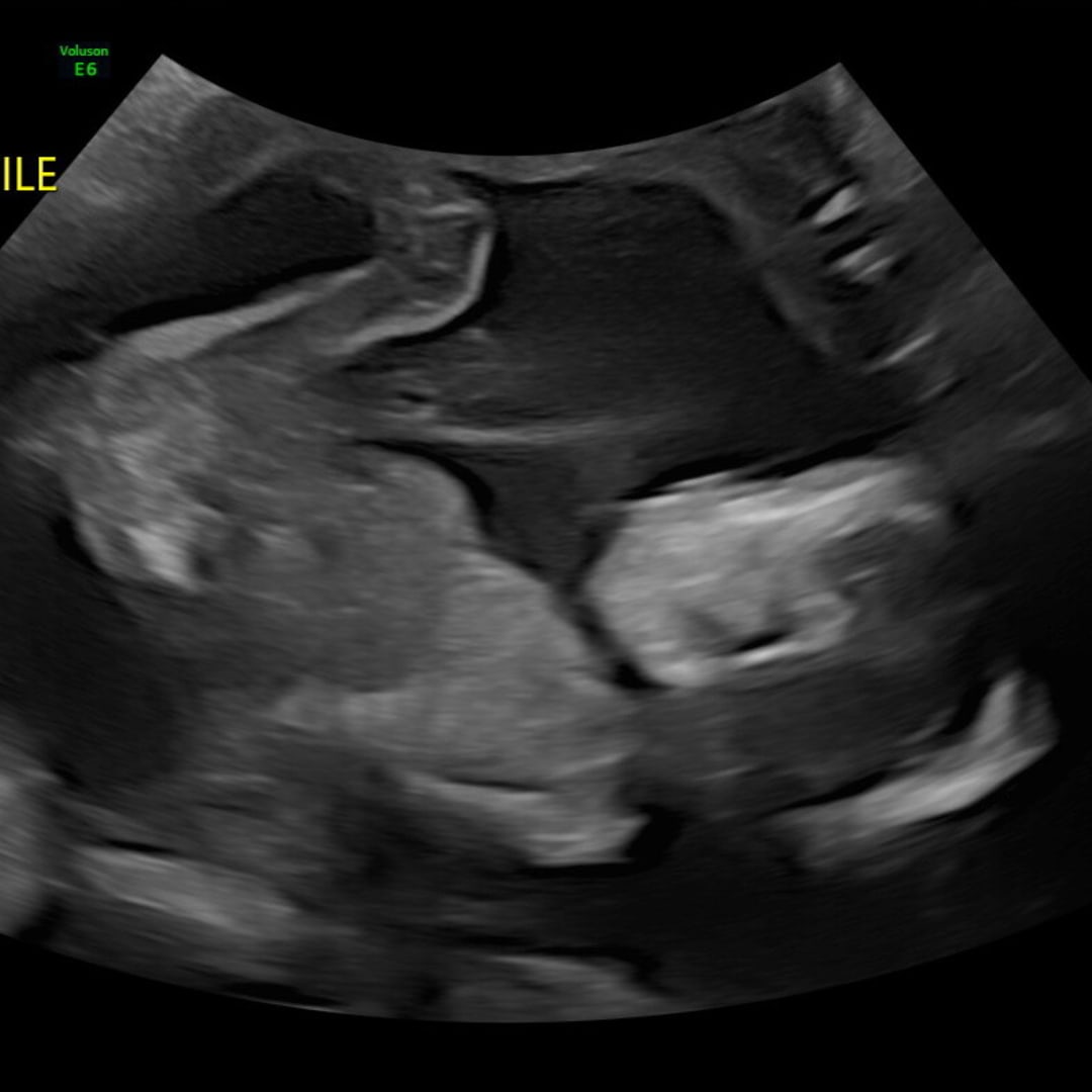 Photo shared by Emily for their Babylist baby registry.