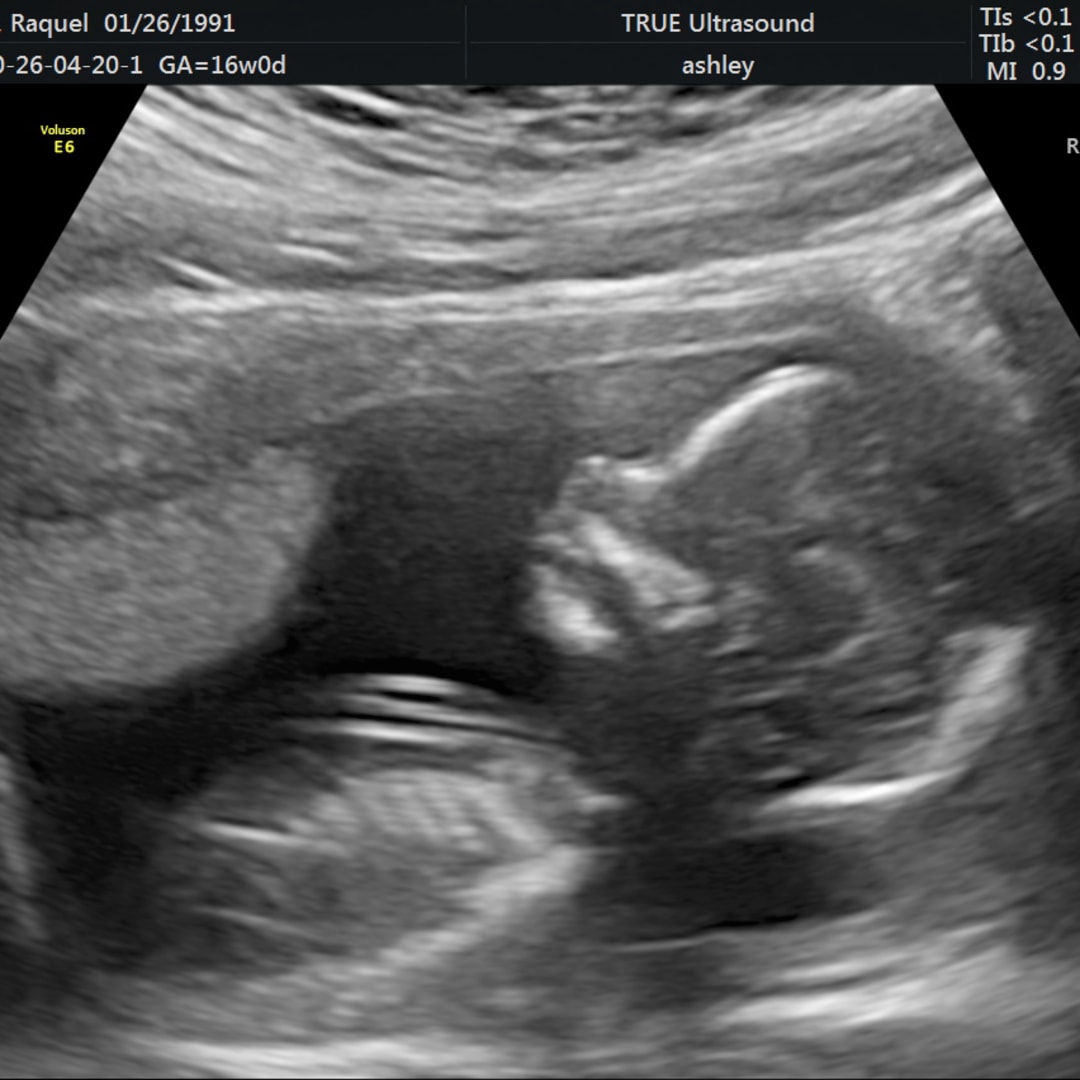 Photo shared by Raquel for their Babylist baby registry.