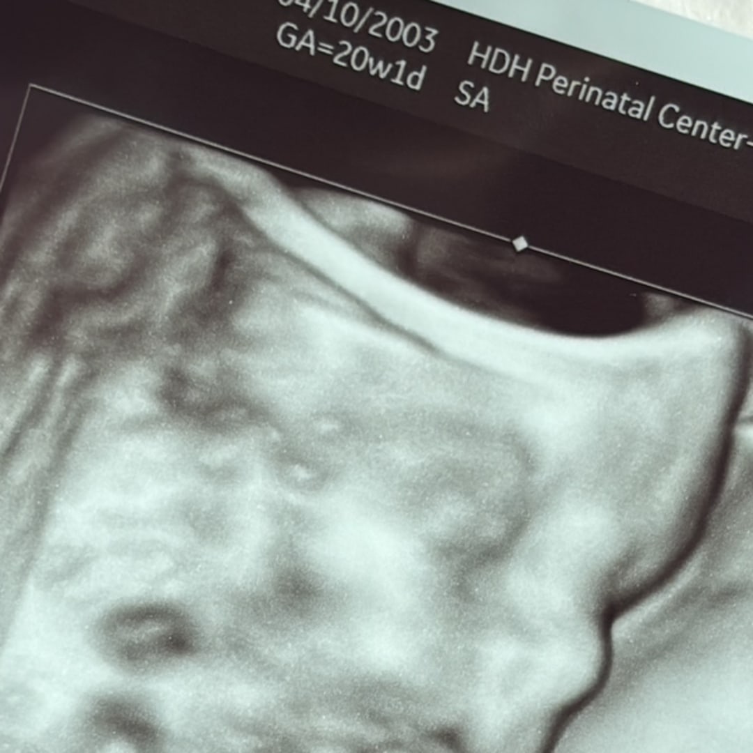 Photo shared by Alma Mia for their Babylist baby registry.