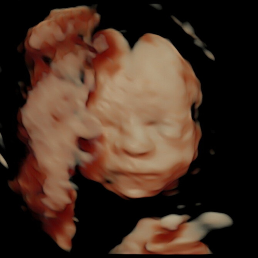 Photo shared by Sophie for their Babylist baby registry.