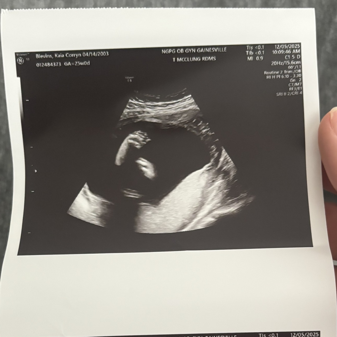 Photo shared by Kaia for their Babylist baby registry.