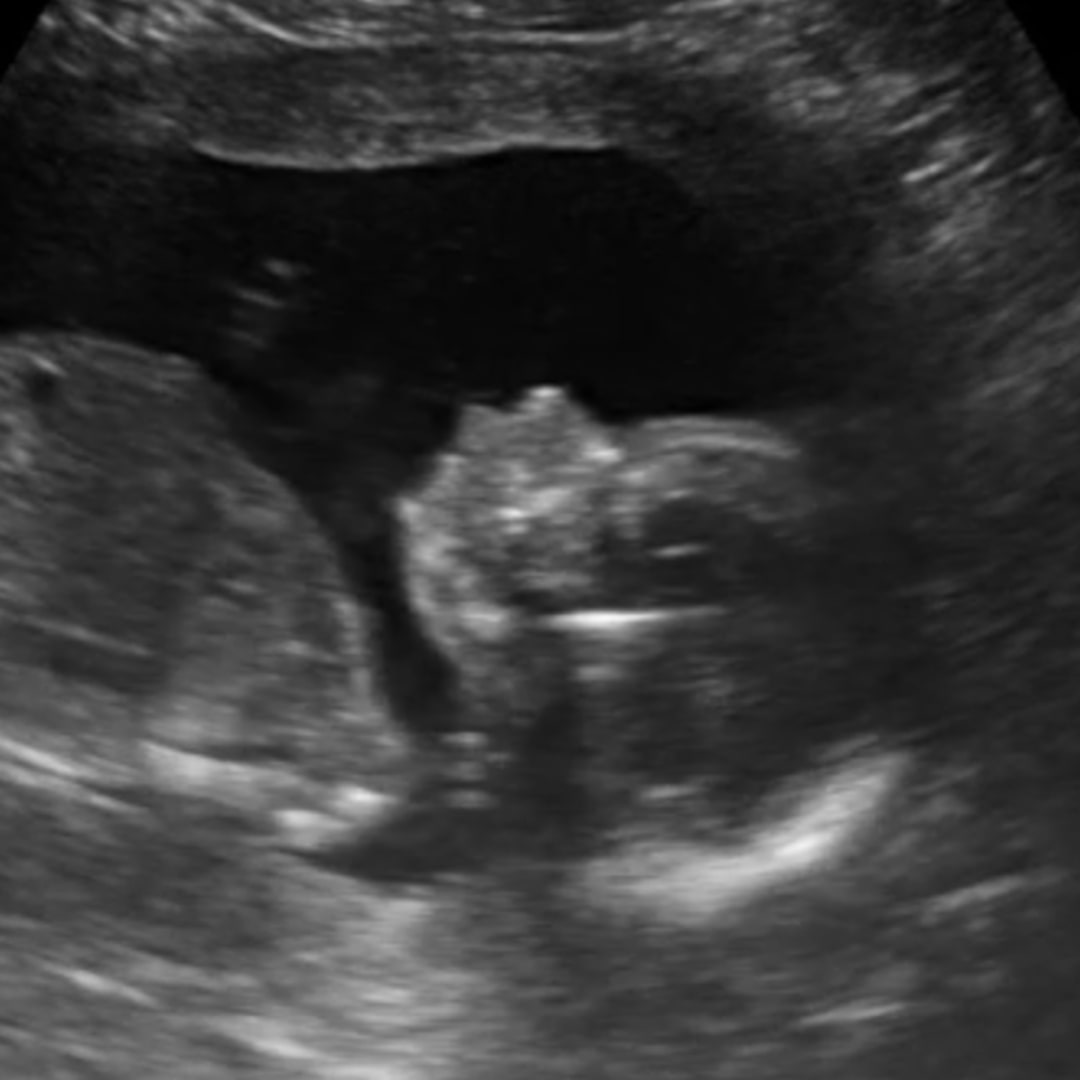 Photo shared by Gina for their Babylist baby registry.