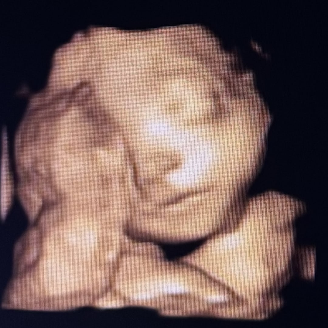 Photo shared by Miranda for their Babylist baby registry.