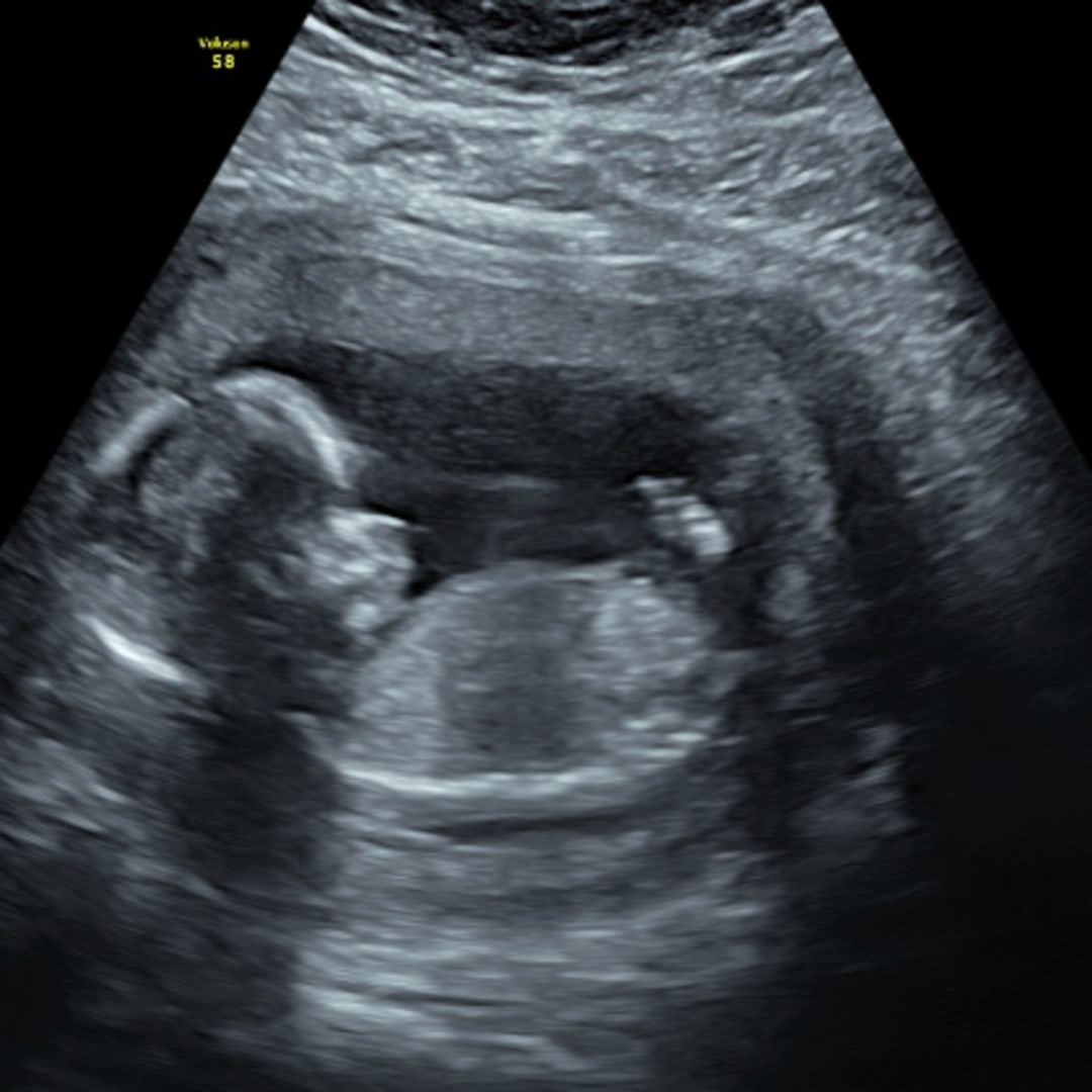 Photo shared by Courtney for their Babylist baby registry.