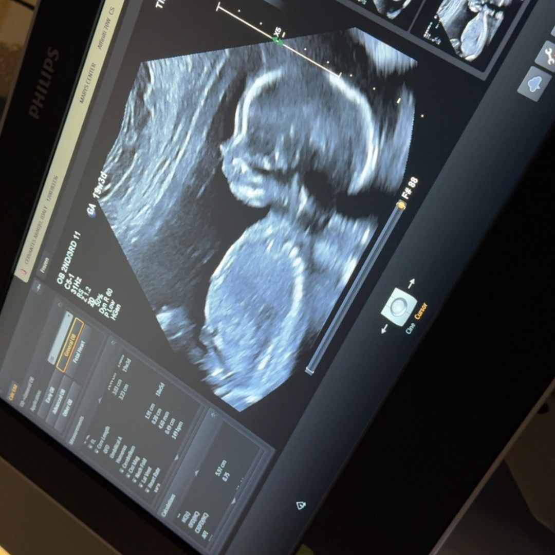 Photo shared by Idaly for their Babylist baby registry.