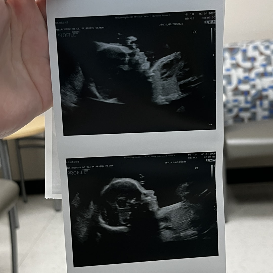 Photo shared by Maranda for their Babylist baby registry.