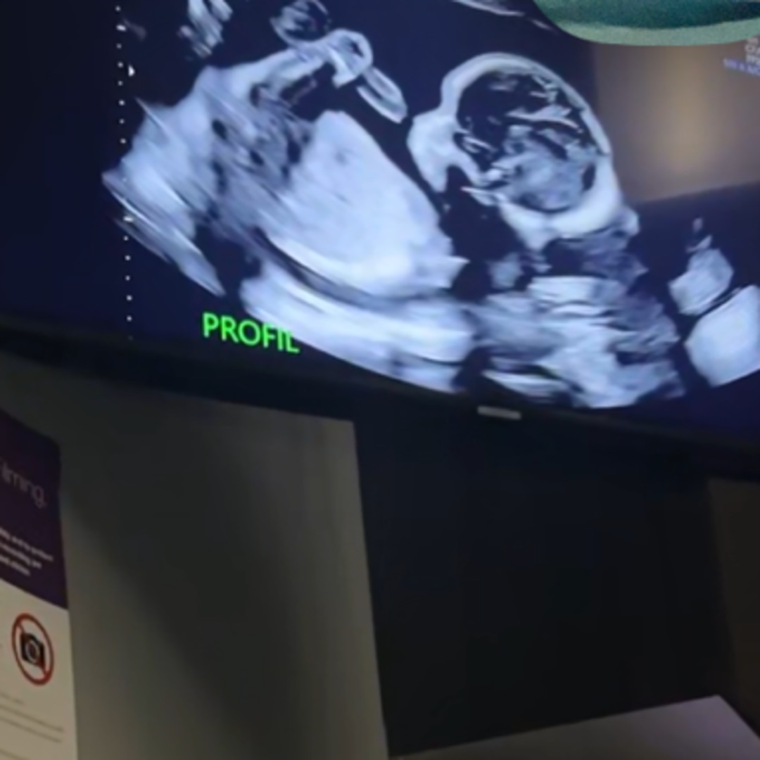 Photo shared by Aveeyah for their Babylist baby registry.