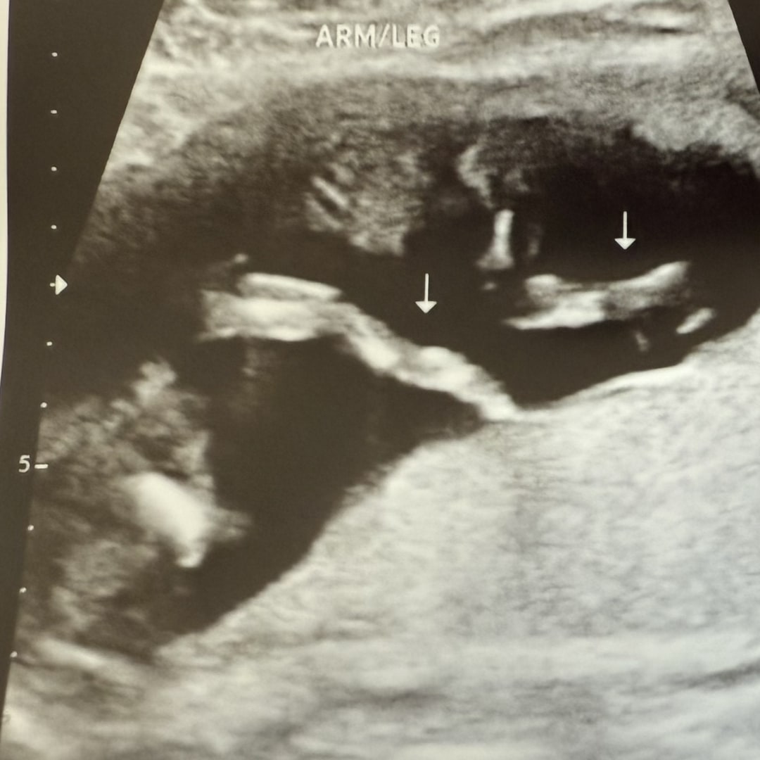 Photo shared by Krista for their Babylist baby registry.
