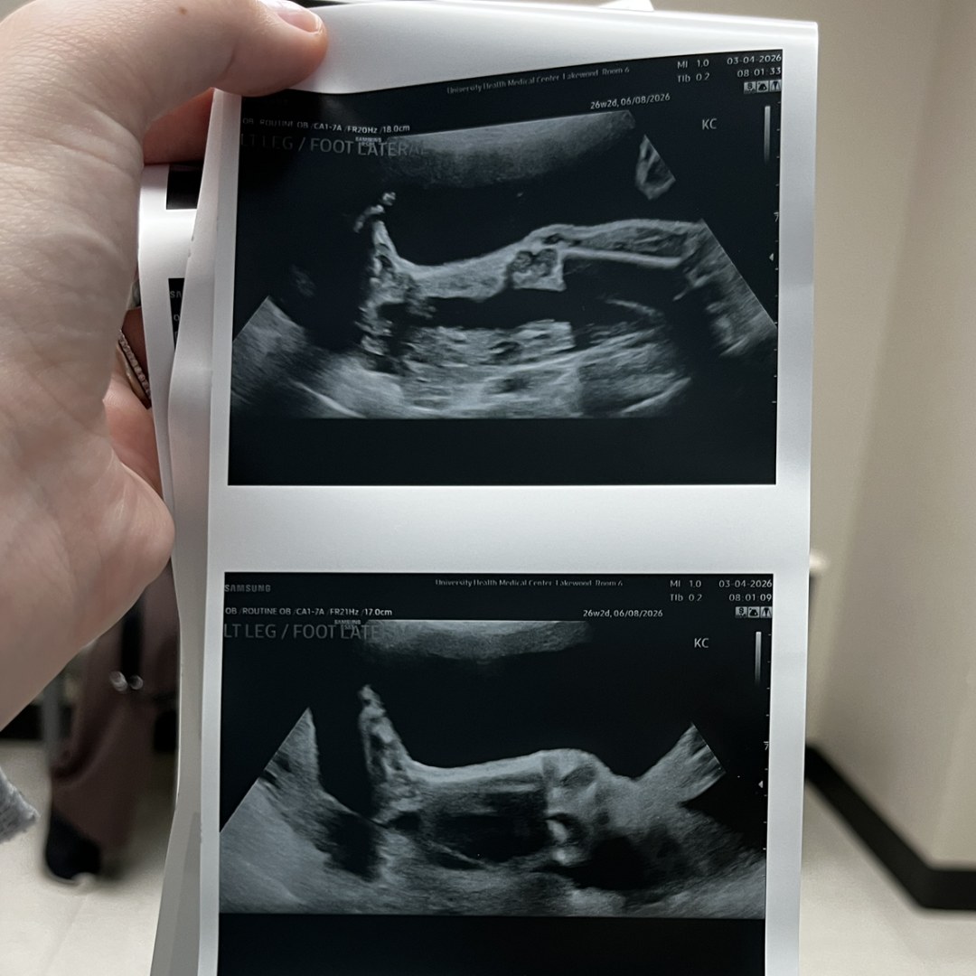 Photo shared by Maranda for their Babylist baby registry.