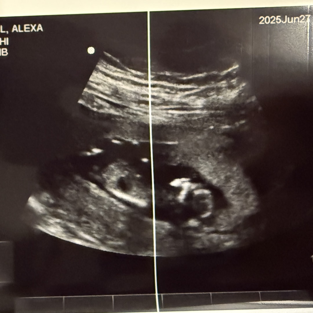 Photo shared by Alexa for their Babylist baby registry.