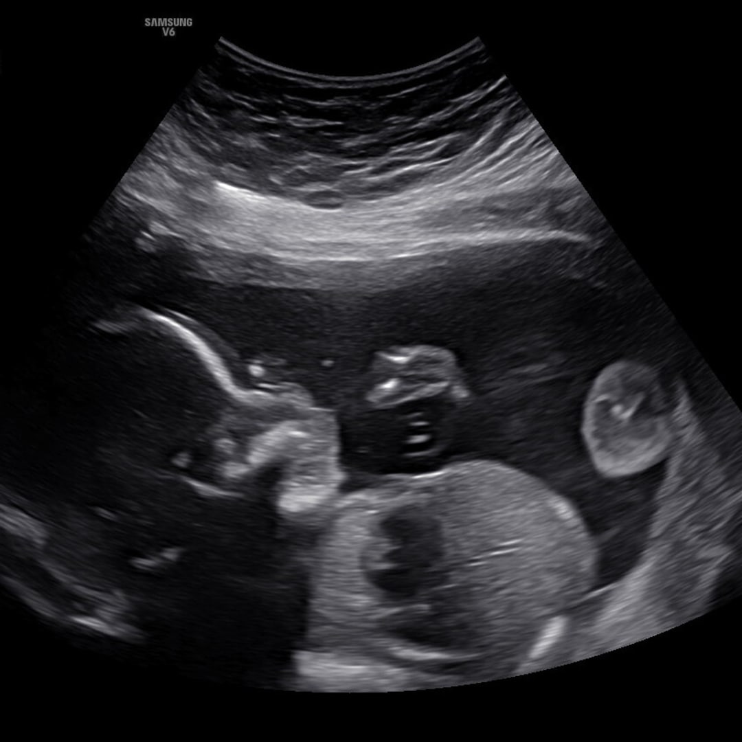 Photo shared by Kaylynn for their Babylist baby registry.