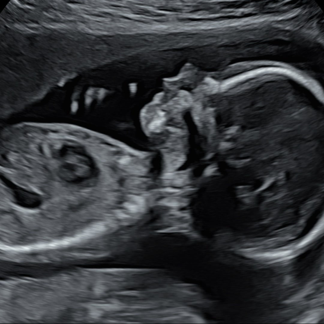 Photo shared by Megan for their Babylist baby registry.
