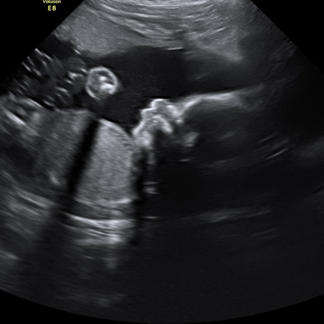 Photo shared by Claudia for their Babylist baby registry.