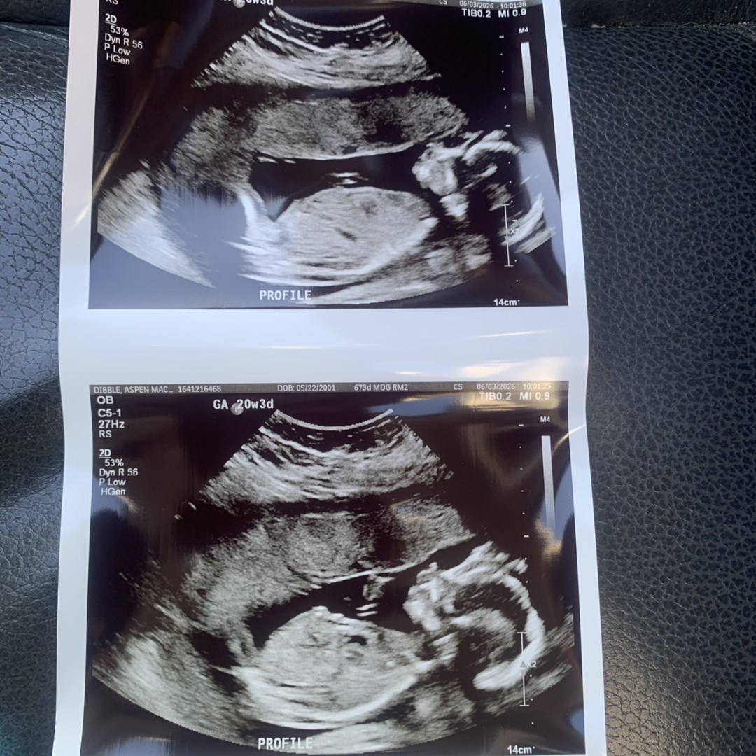 Photo shared by Aspen for their Babylist baby registry.
